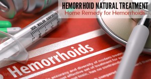 hemorrhoid-natural-treatment