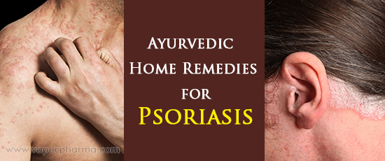 Ayurvedic Home Remedies for Psoriasis