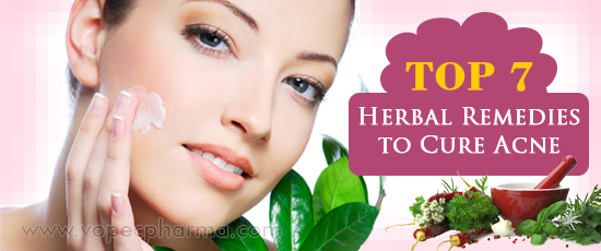 Herbal Remedies to Cure Acne