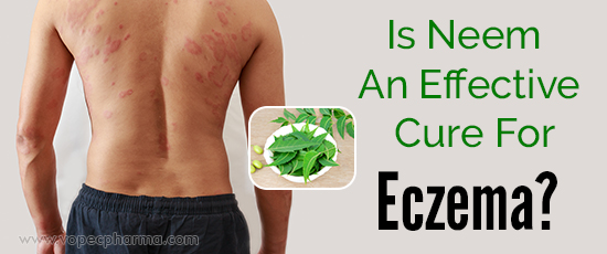 Is Neem An Effective Cure For Eczema