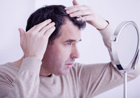  Prevent Hair Loss in Men  