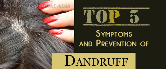 Symptoms and Prevention of Dandruff