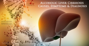 alcoholic-liver-cirrhosis