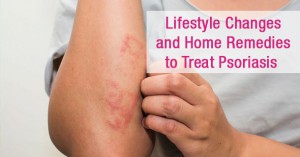 Piles-Home-Remedies